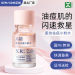 速效祛痘小粉水