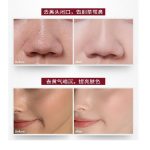 果酸水楊酸精華液